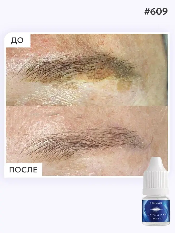 Ремувер #609 "Турбо"